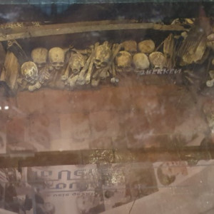 skeletten (Aangepast)